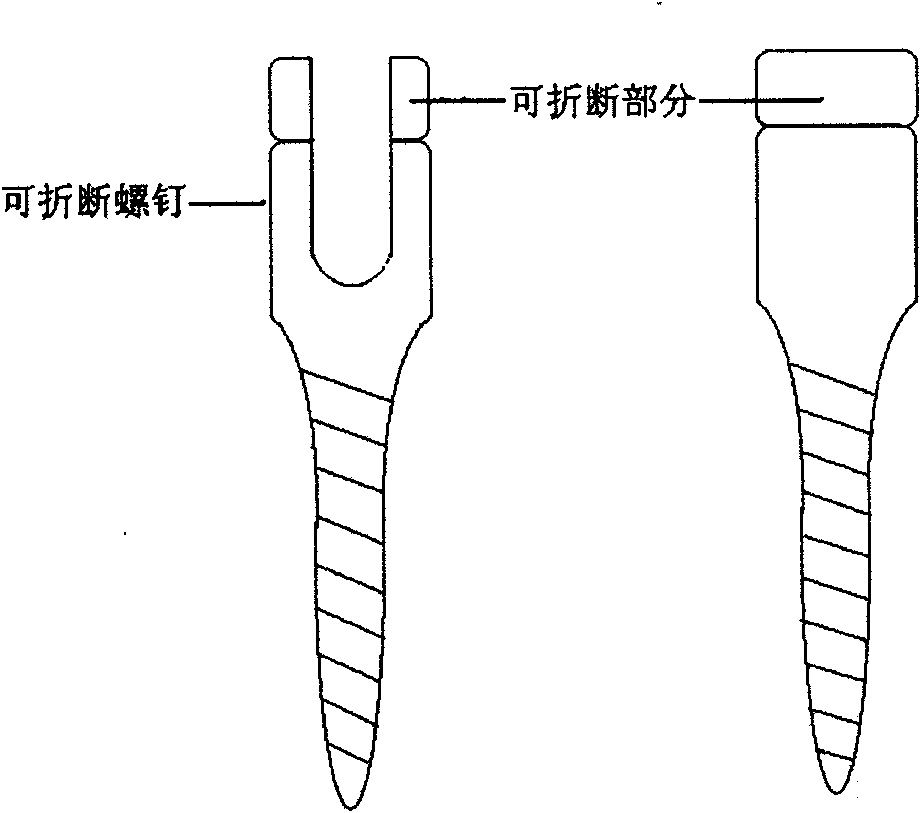 Dynamic stabilization system for vertebral column