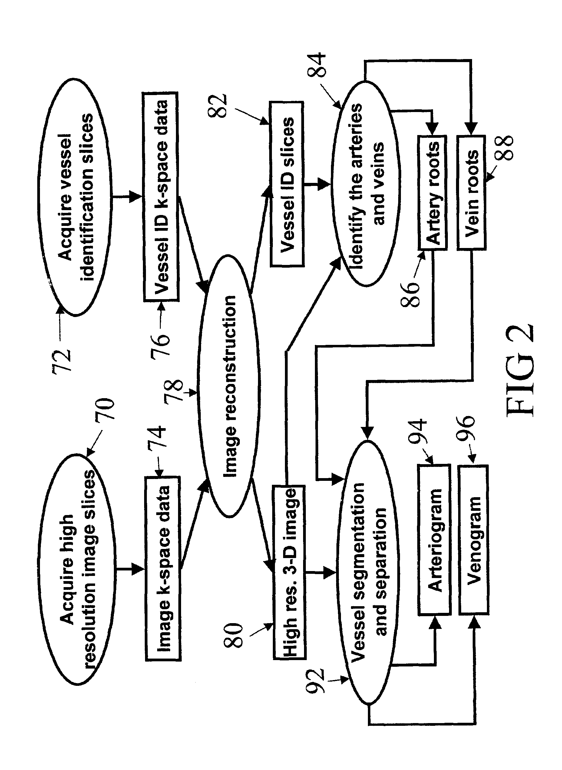 Automatic vessel indentification for angiographic screening