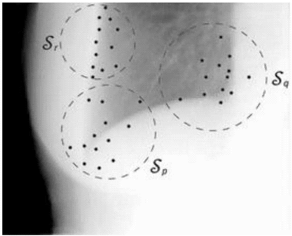 Efficient medical image segmentation method based on game framework