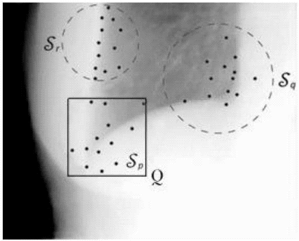 Efficient medical image segmentation method based on game framework