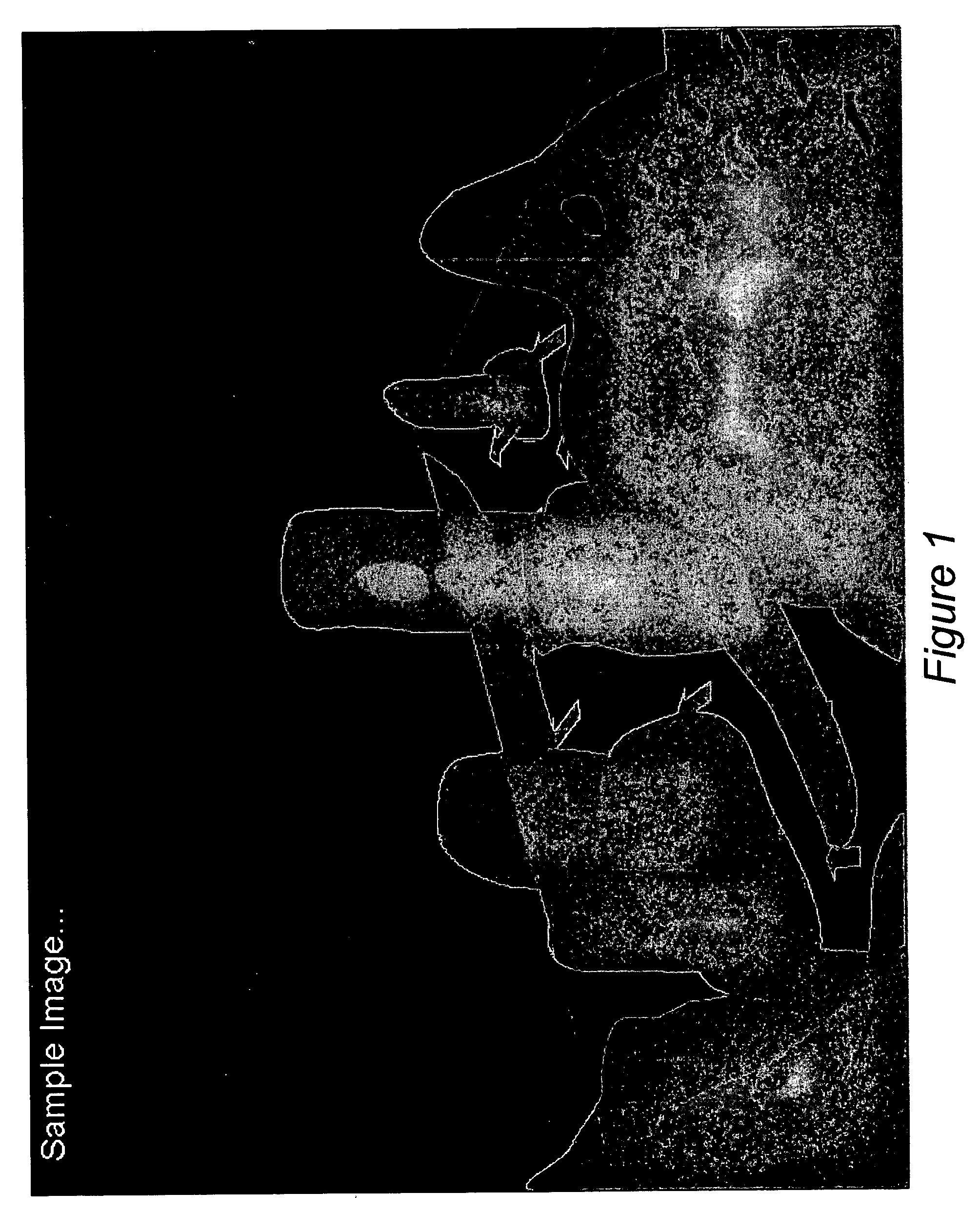 Narrow field abstract meta-data image compression