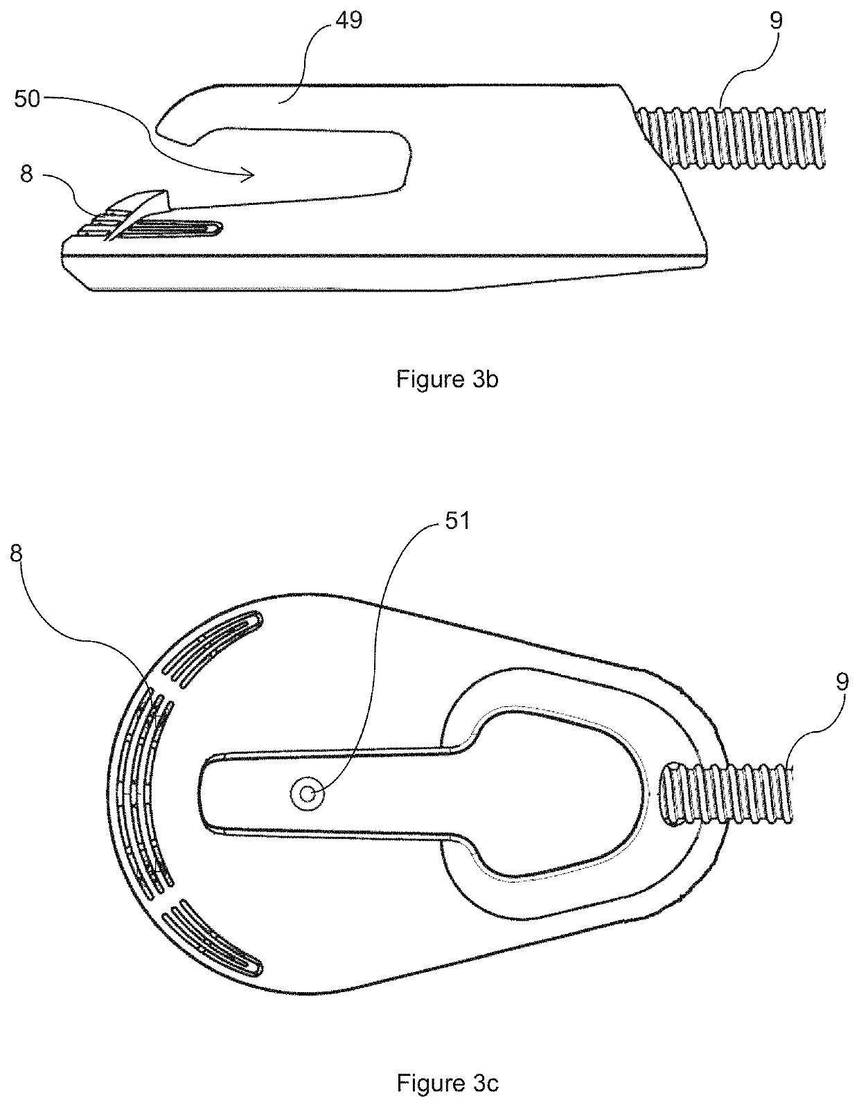 Aesthetic method of biological structure treatment by magnetic field