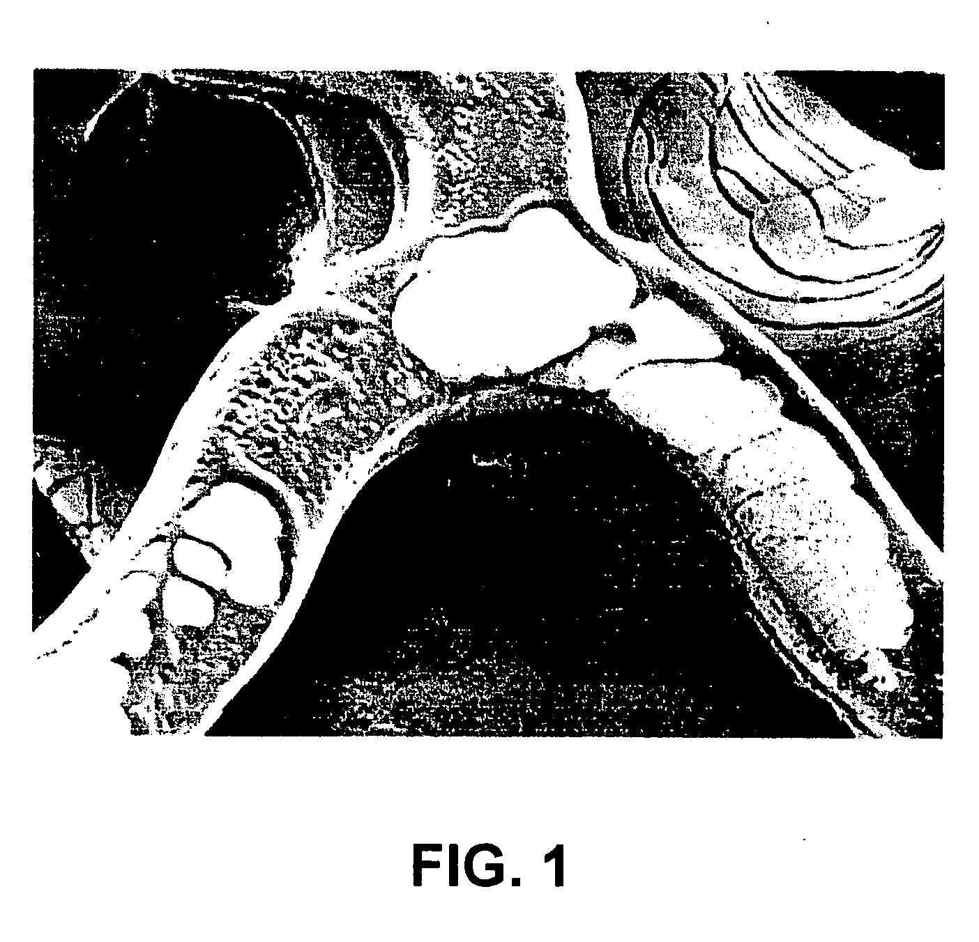 Poly(ester amide) coating composition for implantable devices