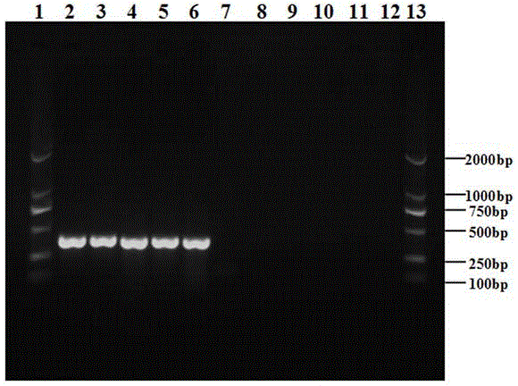 Guava colletotrichum orbiculare specificity PCR detecting primer and detecting method of guava colletotrichum orbiculare