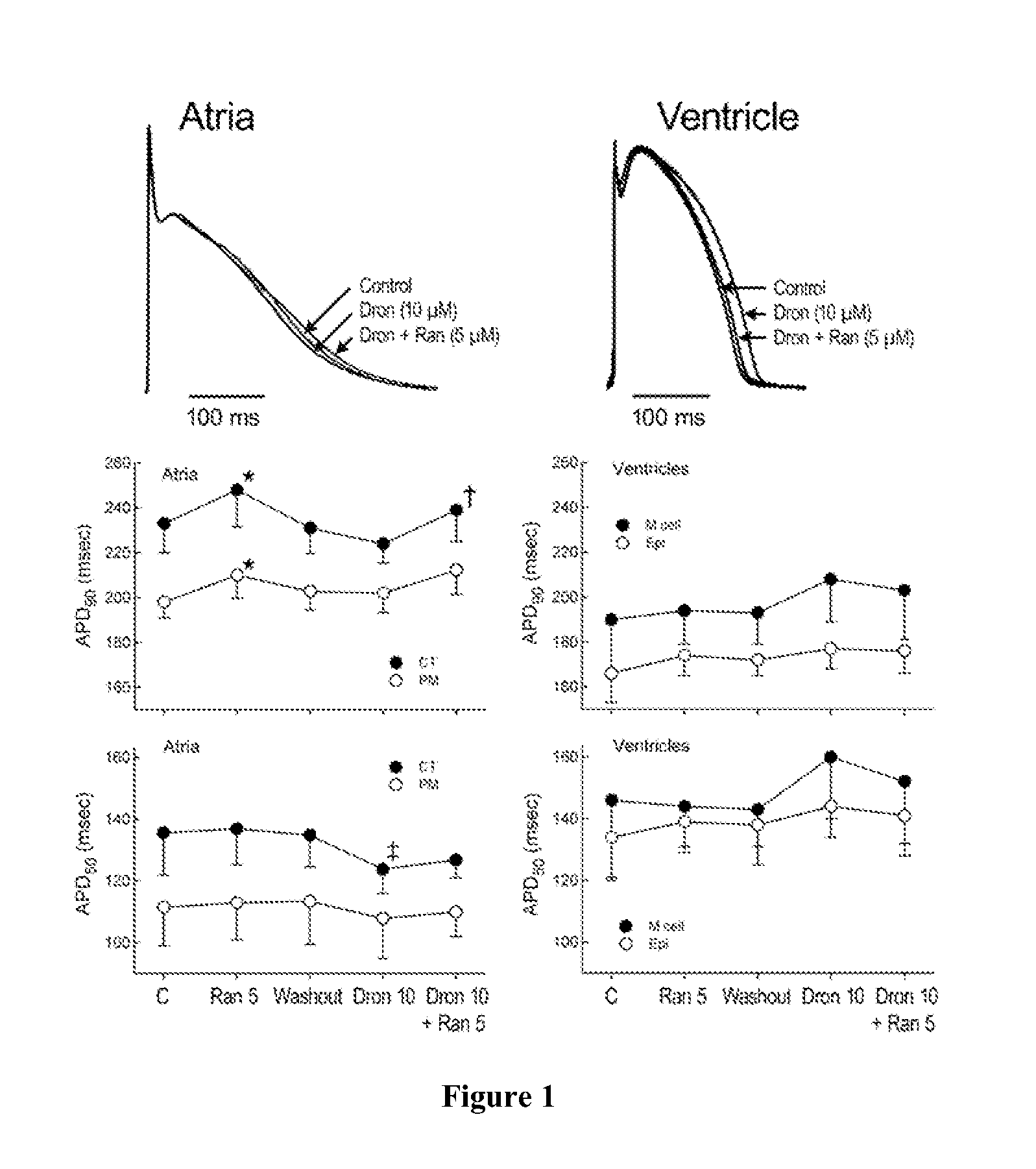 Method of treating atrial fibrillation