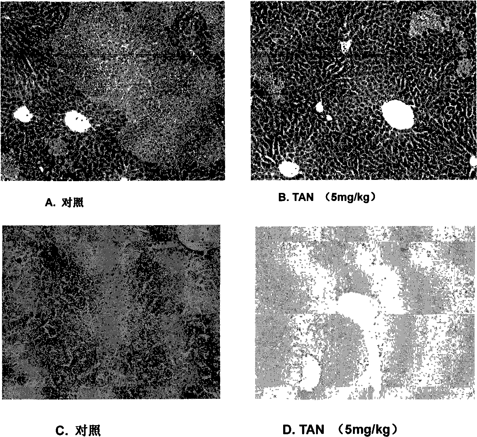 Traditional Chinese medicine active monomer component with liver protection function and uses thereof