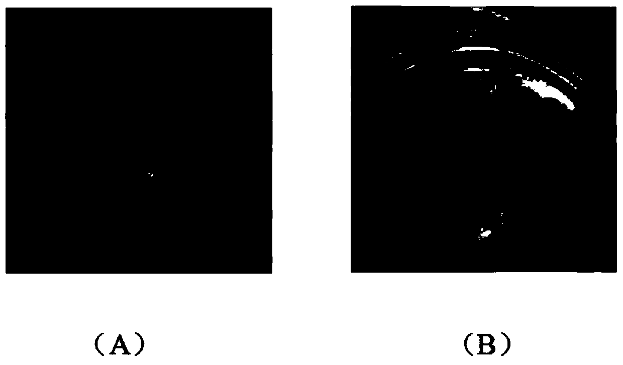 Preparation method of brain acellular stent