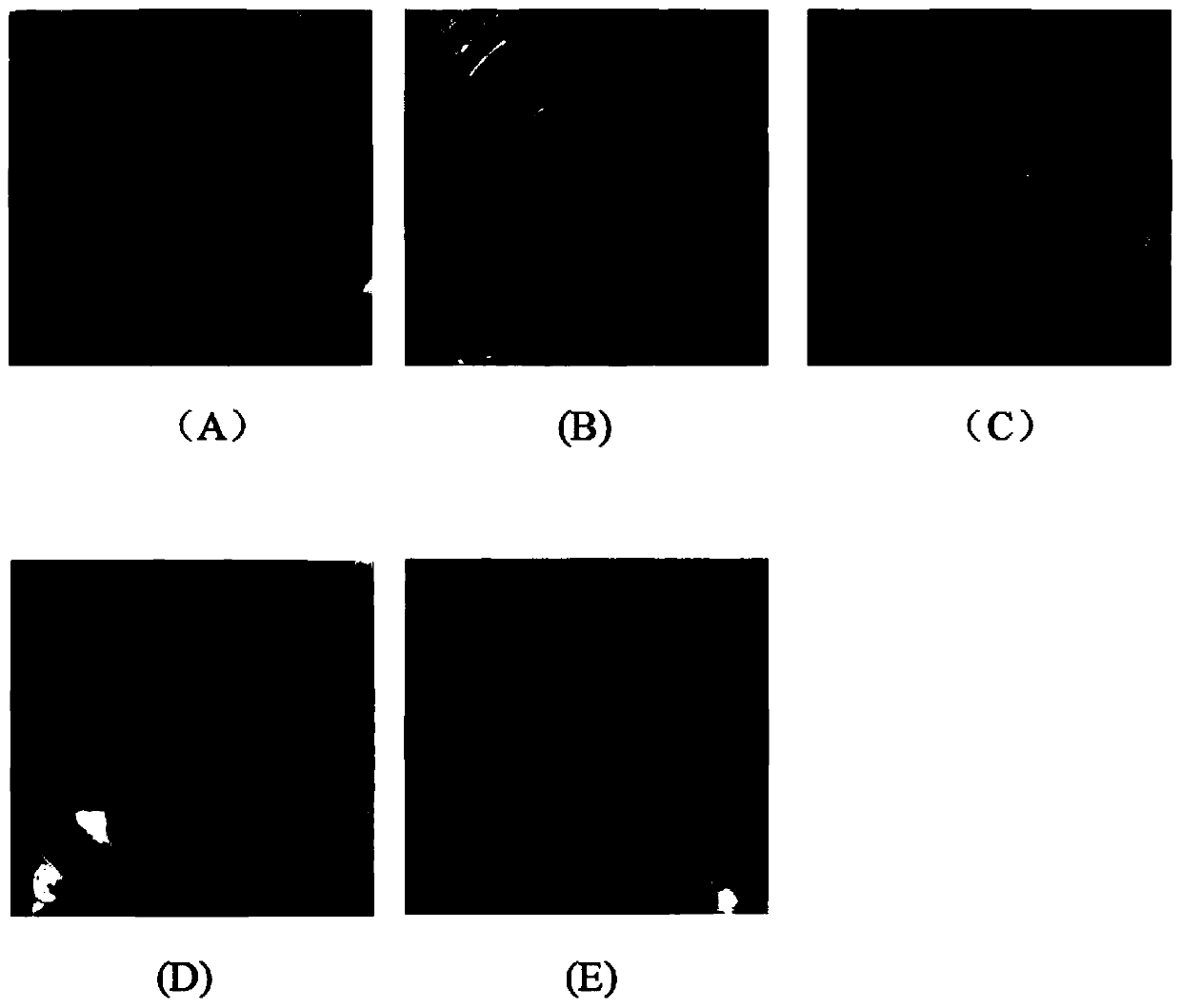 Preparation method of brain acellular stent