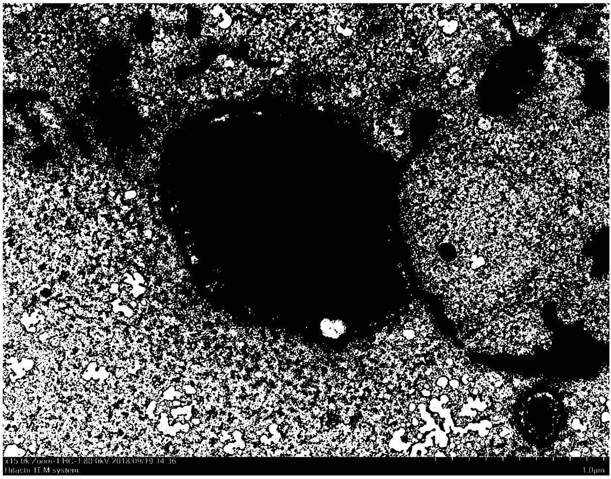 Preparation method of antitumor microparticles, drug and application