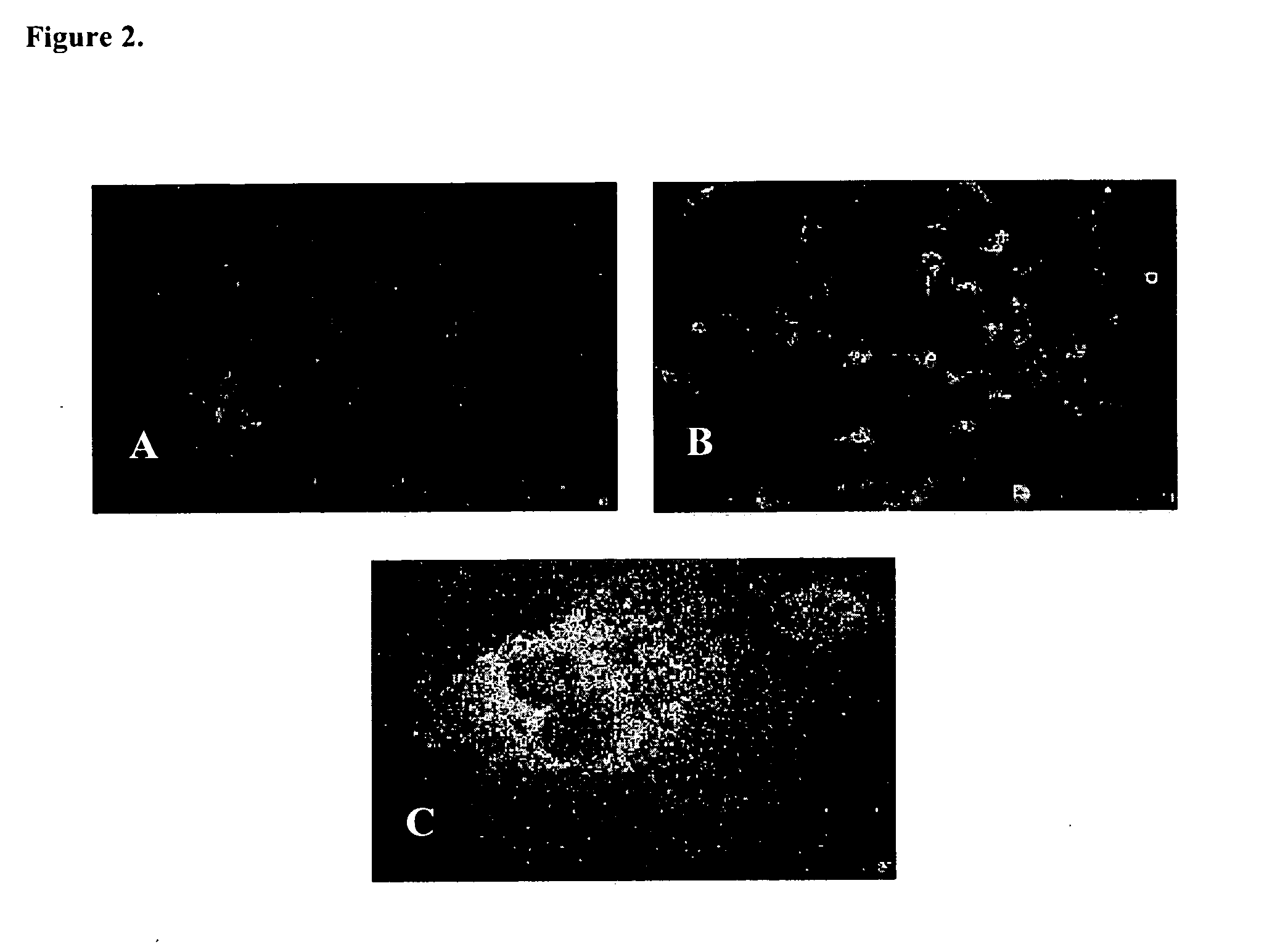 Treatment of presbyopia with picolinic acid and its analogs