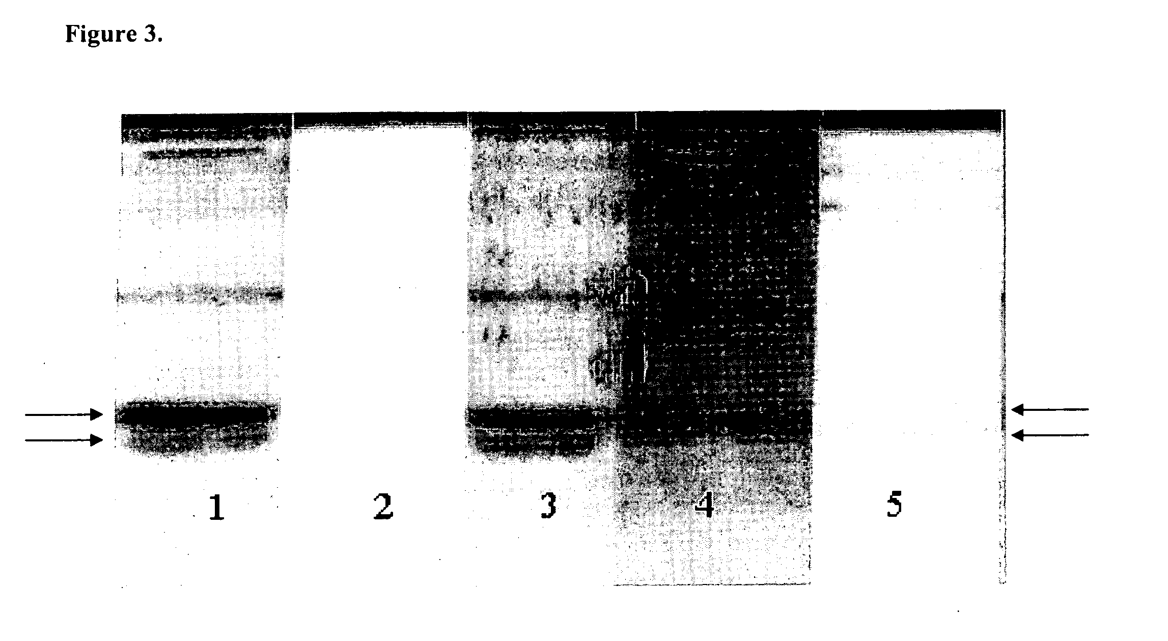 Treatment of presbyopia with picolinic acid and its analogs