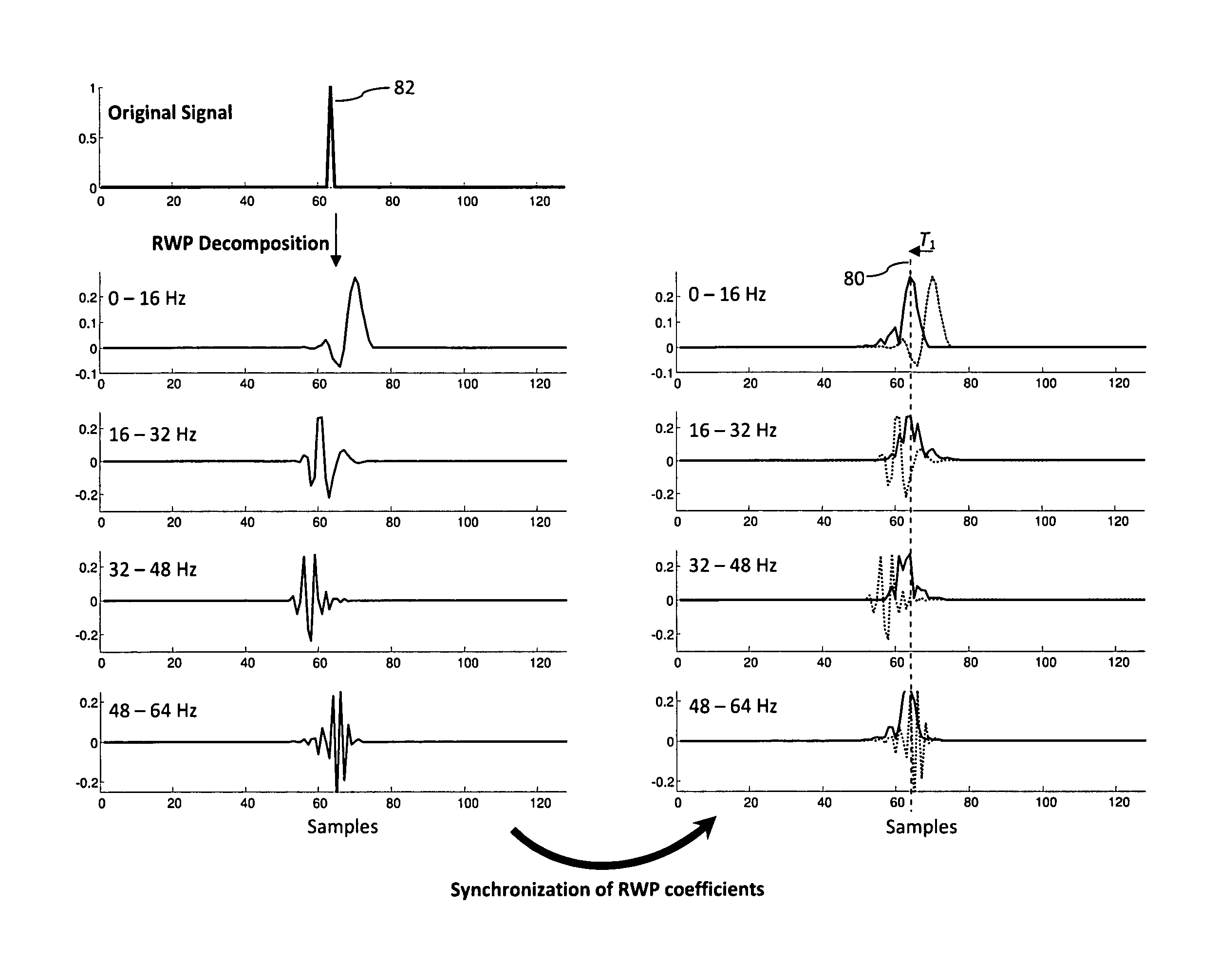 Method for amplifying abnormal pattern signal in observed brain activity of a subject for diagnosis or treatment