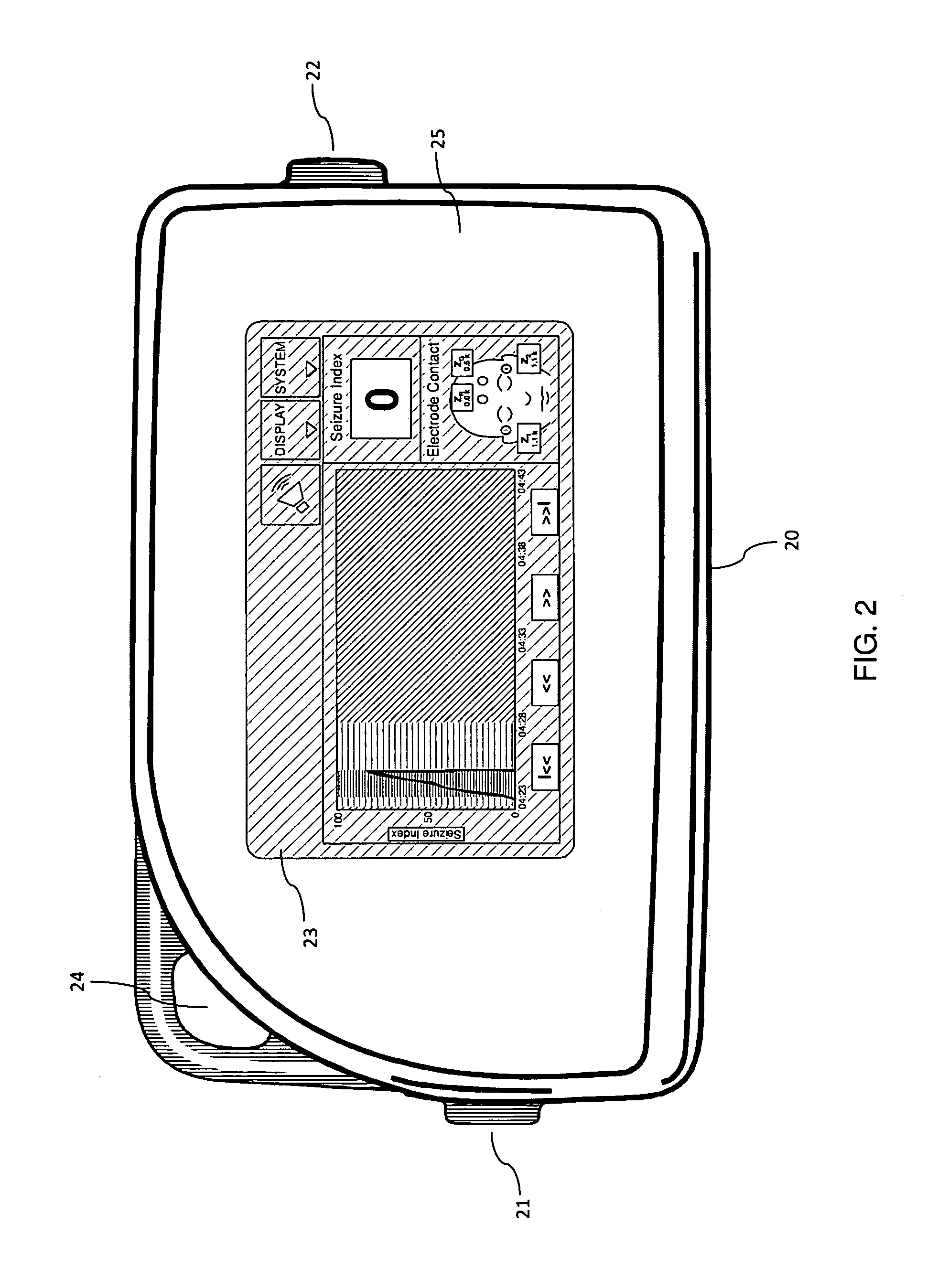 Method for amplifying abnormal pattern signal in observed brain activity of a subject for diagnosis or treatment