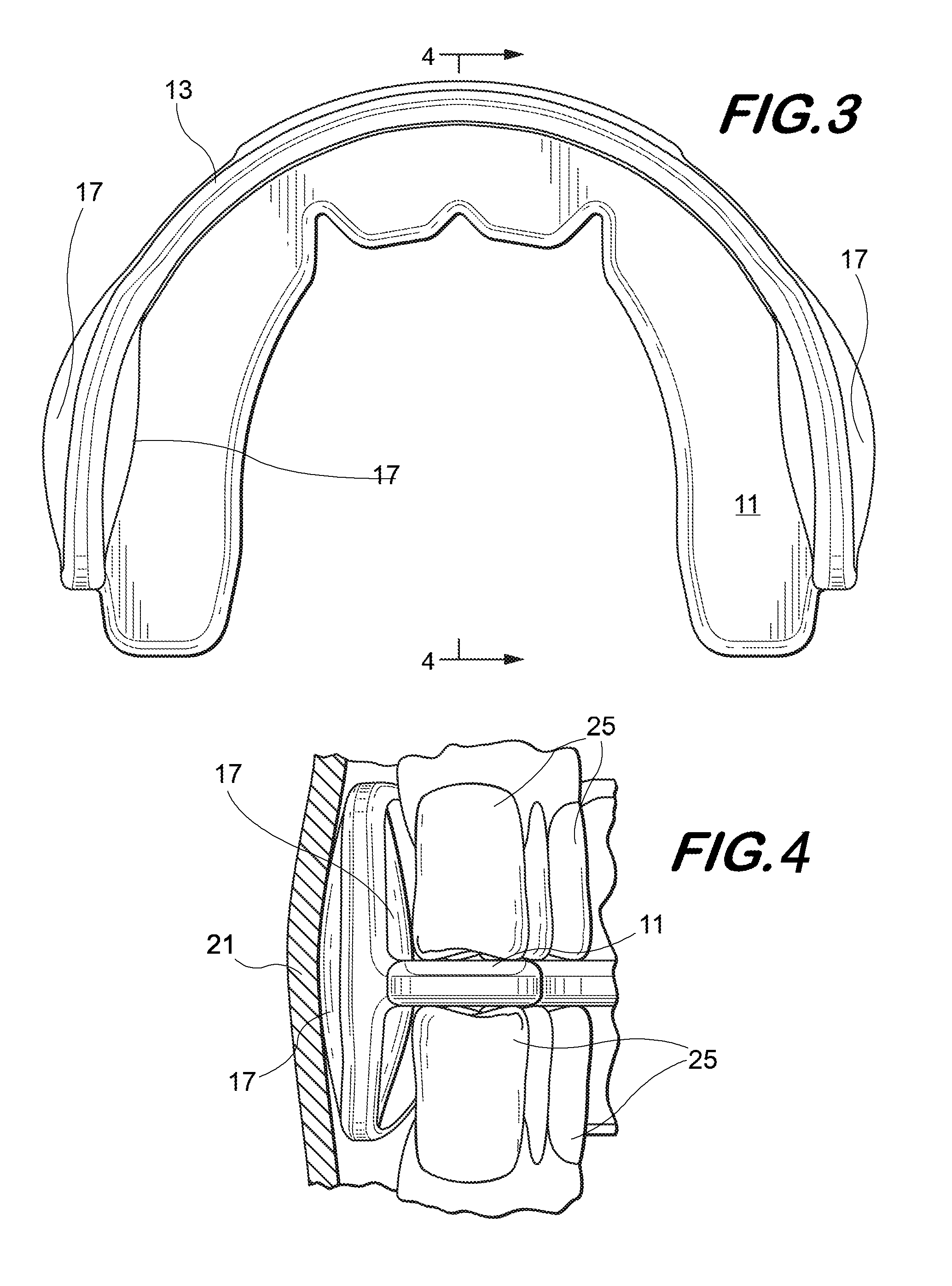 Stabilizer Mouthguard