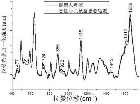 Method for detecting biochemical components of throat swab sample by adopting surface enhanced micro-Raman spectroscopy