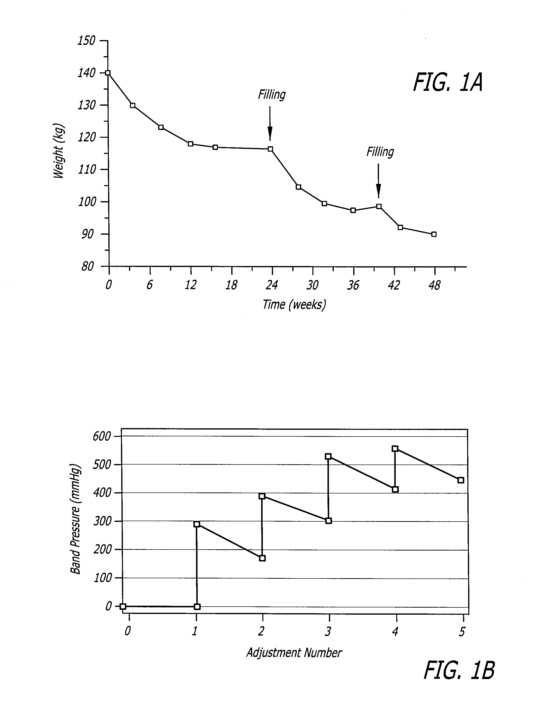 Assembly and method for automatically controlling pressure for a gastric band