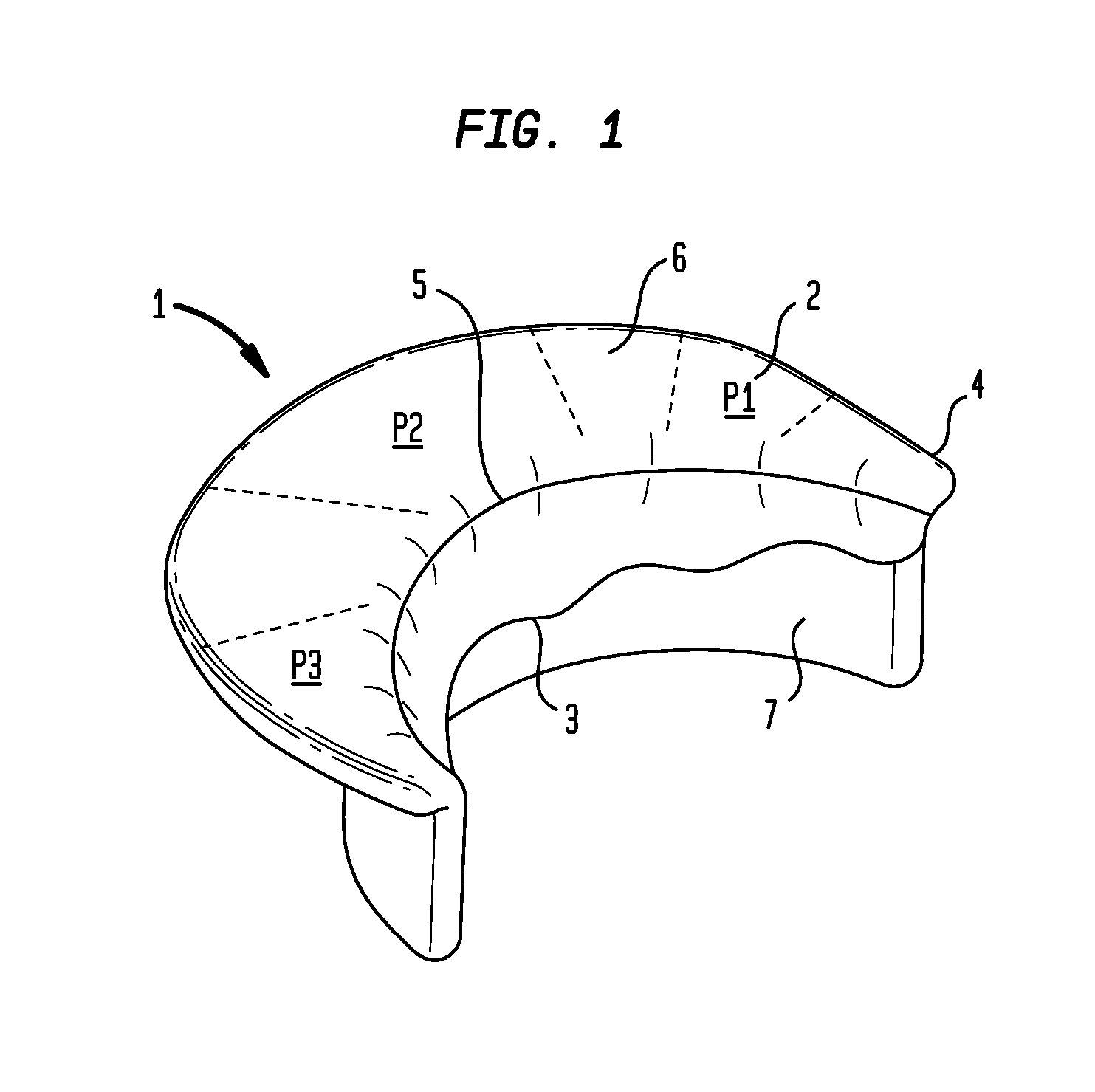 Mitral valve leaflet clip