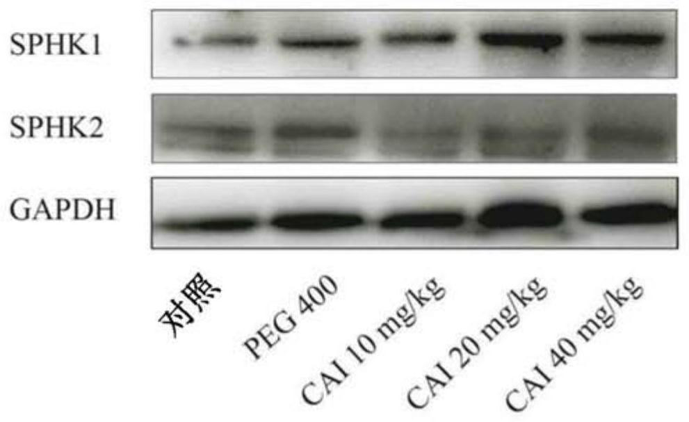 Application of carboxamide triazole compound or salt thereof as sphingosine kinase 2 inhibitor