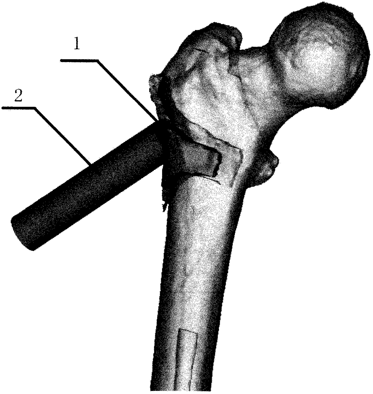 Preparation and testing method of a three-dimensional decompression device for avascular necrosis of the femoral head