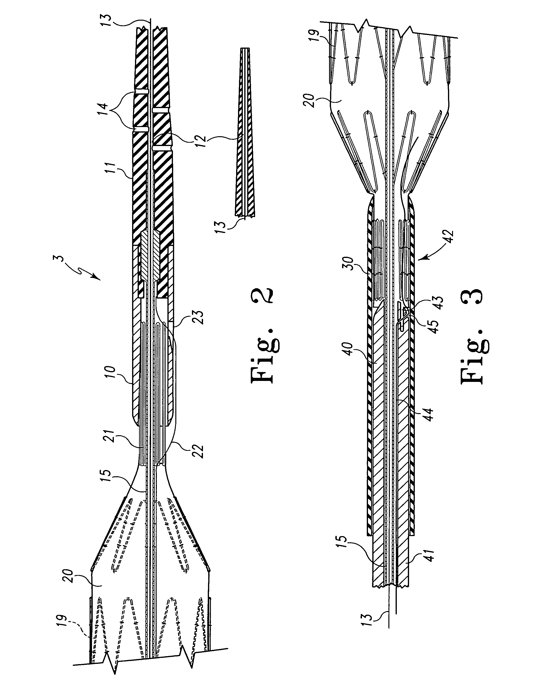 Fenestrated endoluminal stent system