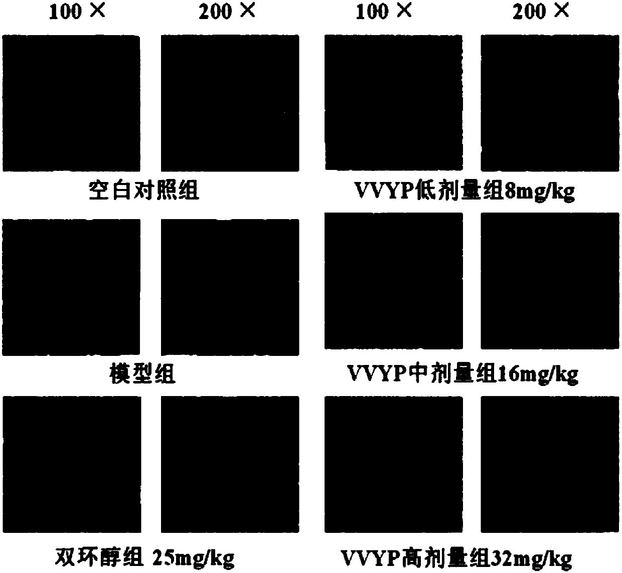 VVYP used for preventing and/or treating liver injuries