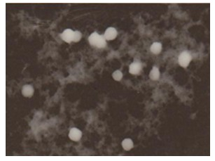 Curcumin microemulsion ion sensitive in situ gel preparation for intranasal administration and preparation method thereof