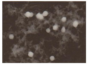 Curcumin microemulsion ion sensitive in situ gel preparation for intranasal administration and preparation method thereof