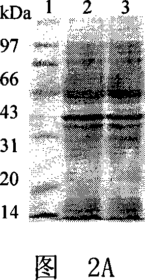 Interfusion protein between diphtheria toxin and GM CSF mutant, coded gene and application