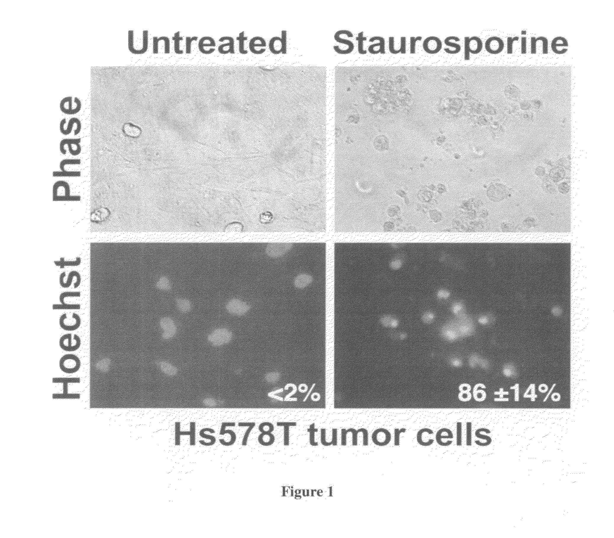 Method of determining susceptibility of a tumor cell to a chemotherapeutic agent: novel use of herpes simplex virus