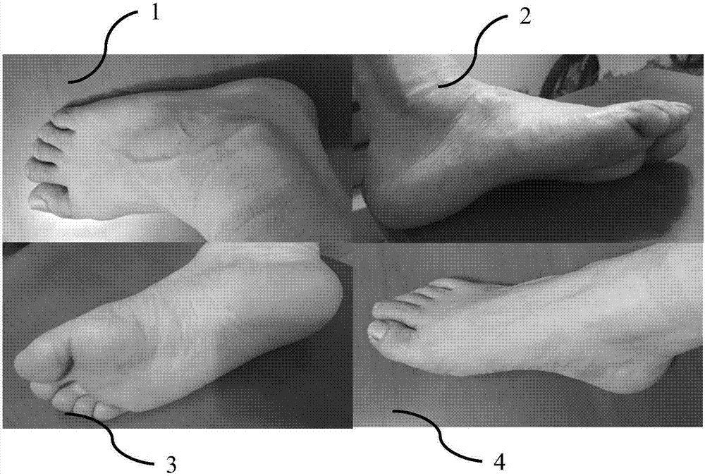 Correction shoe making method and system based on image recognition and three-dimensional modeling technique