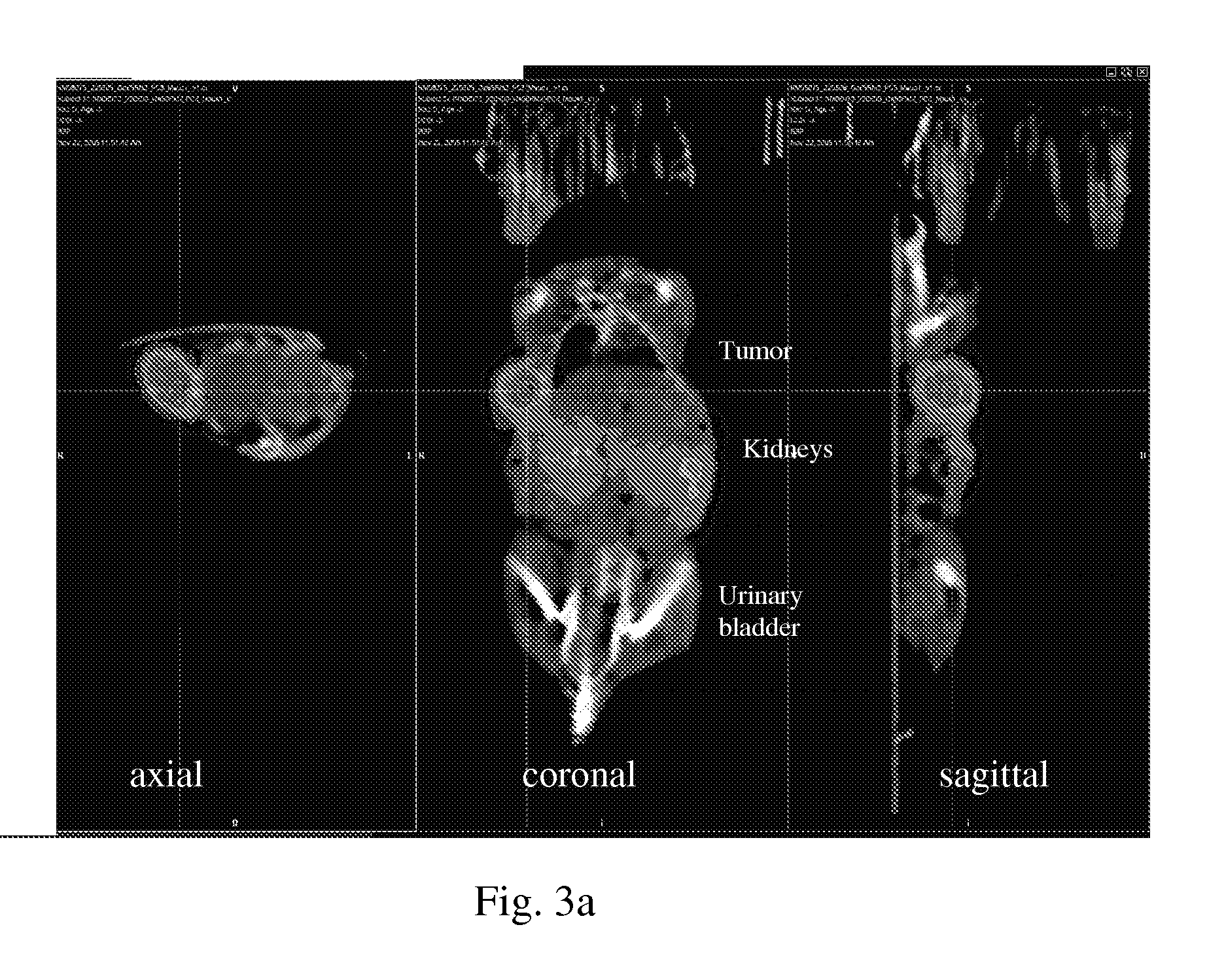 Bombesin Analog Peptide Antagonist Conjugates