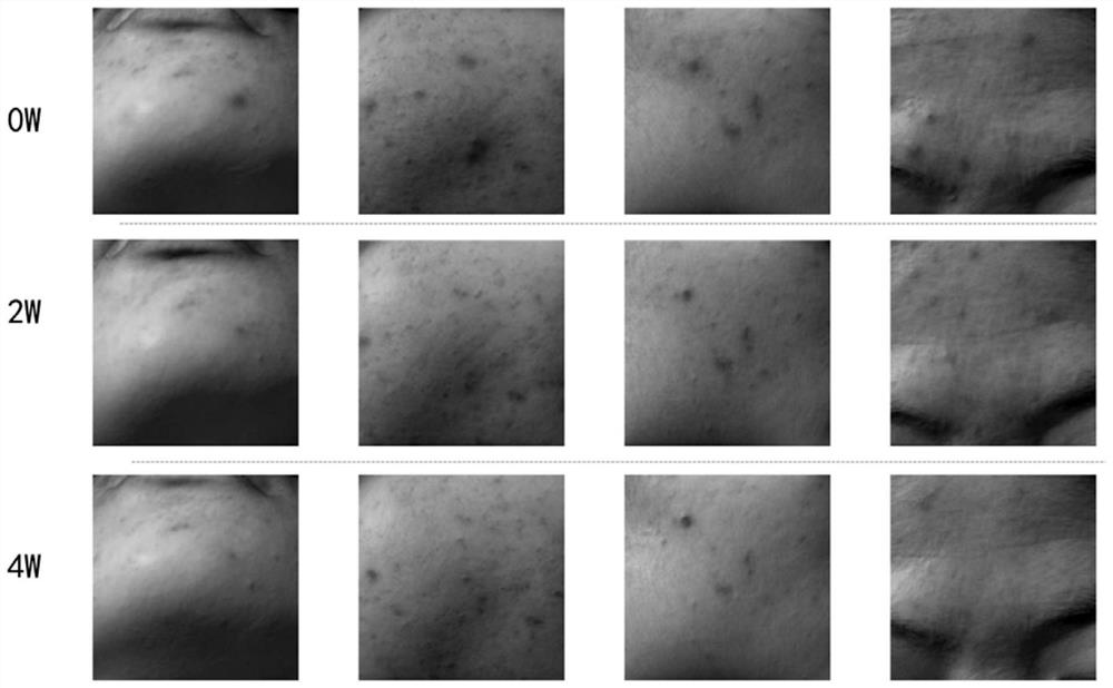 Anti-acne and anti-inflammatory composition and preparation method and application thereof