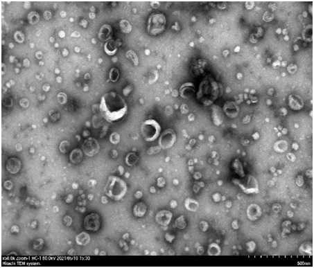 Exosome separation and purification method