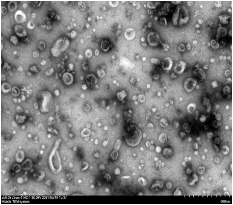 Exosome separation and purification method