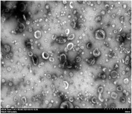 Exosome separation and purification method