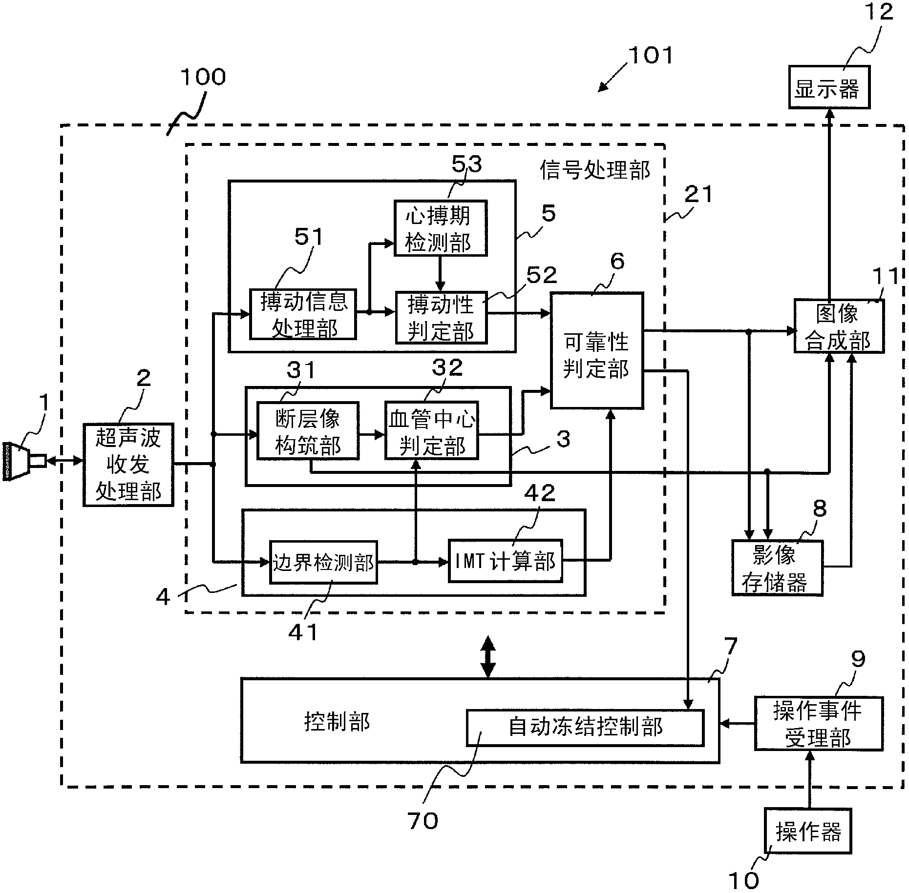 Ultrasound diagnostic apparatus and ultrasound diagnostic apparatus control method