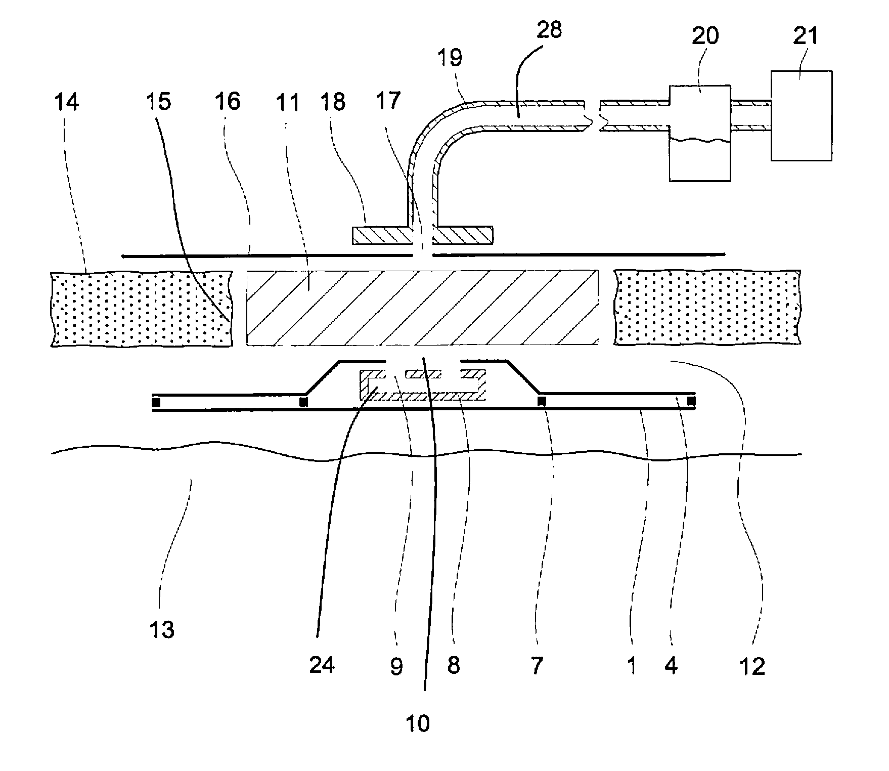 Wound dressing for negative-pressure therapy