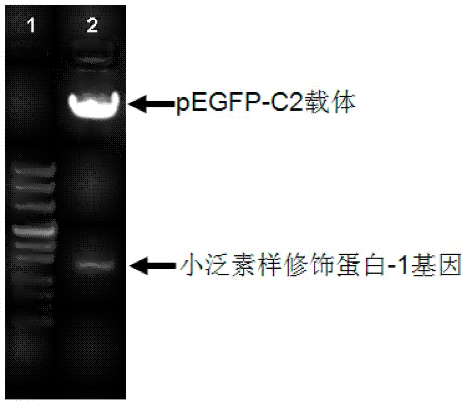 Biological detection method for small ubiquitin-like modification