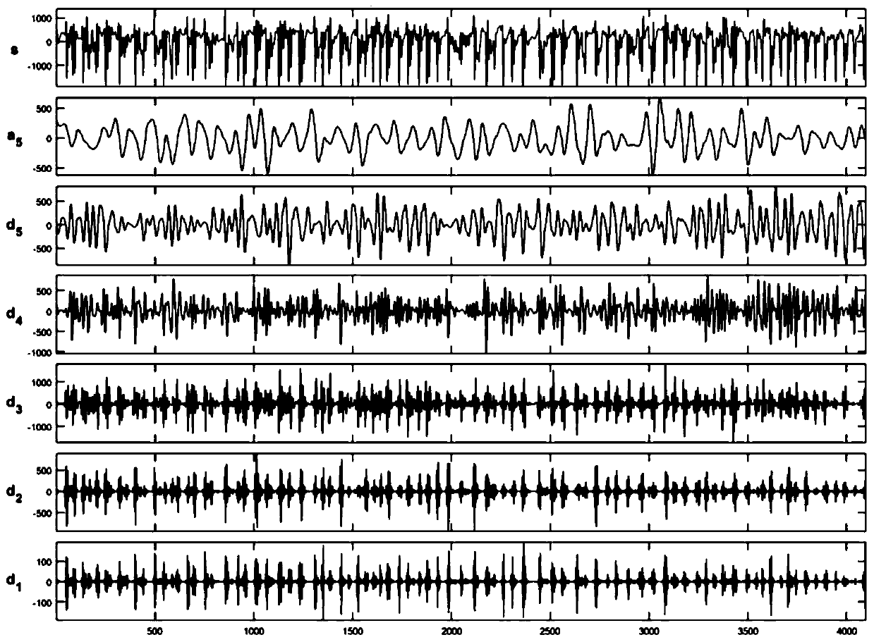 Epileptic seizure EEG signal classification system based on nonlinear dynamics features