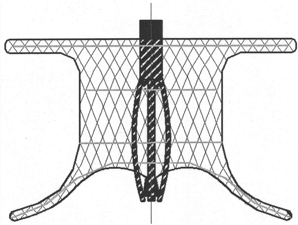 Degradable woven occluder