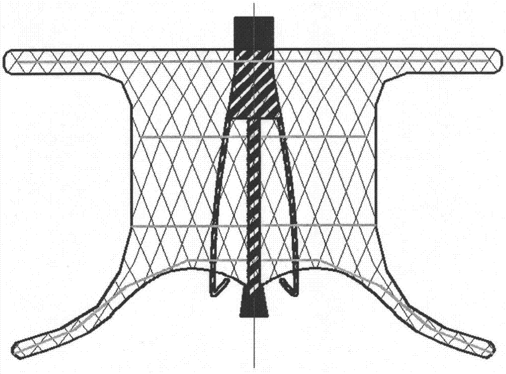 Degradable woven occluder