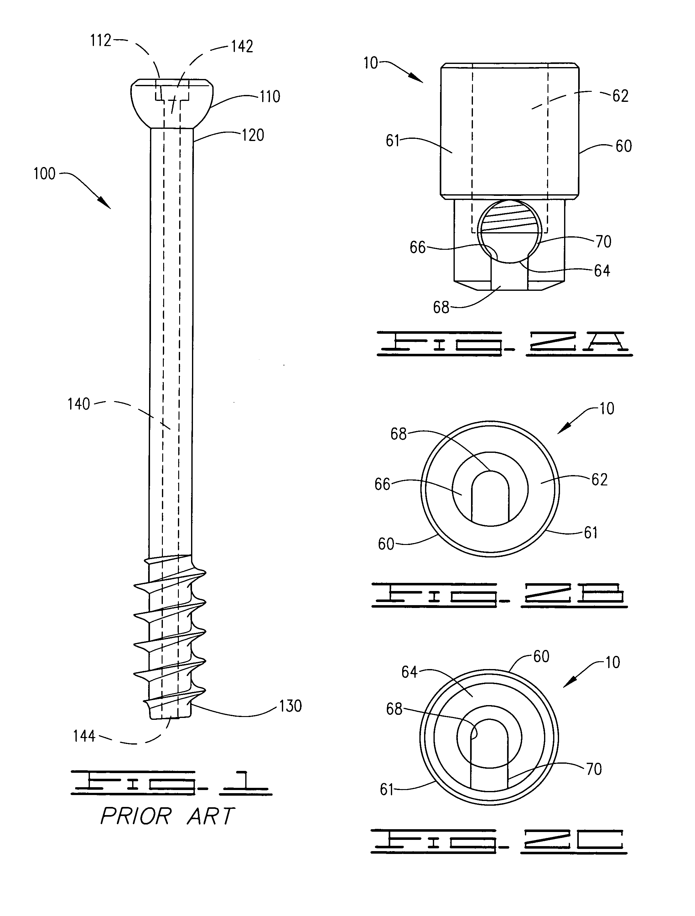 Pressured syringe for the injection of a viscous liquid through a cannulated surgical screw bone filler adapter