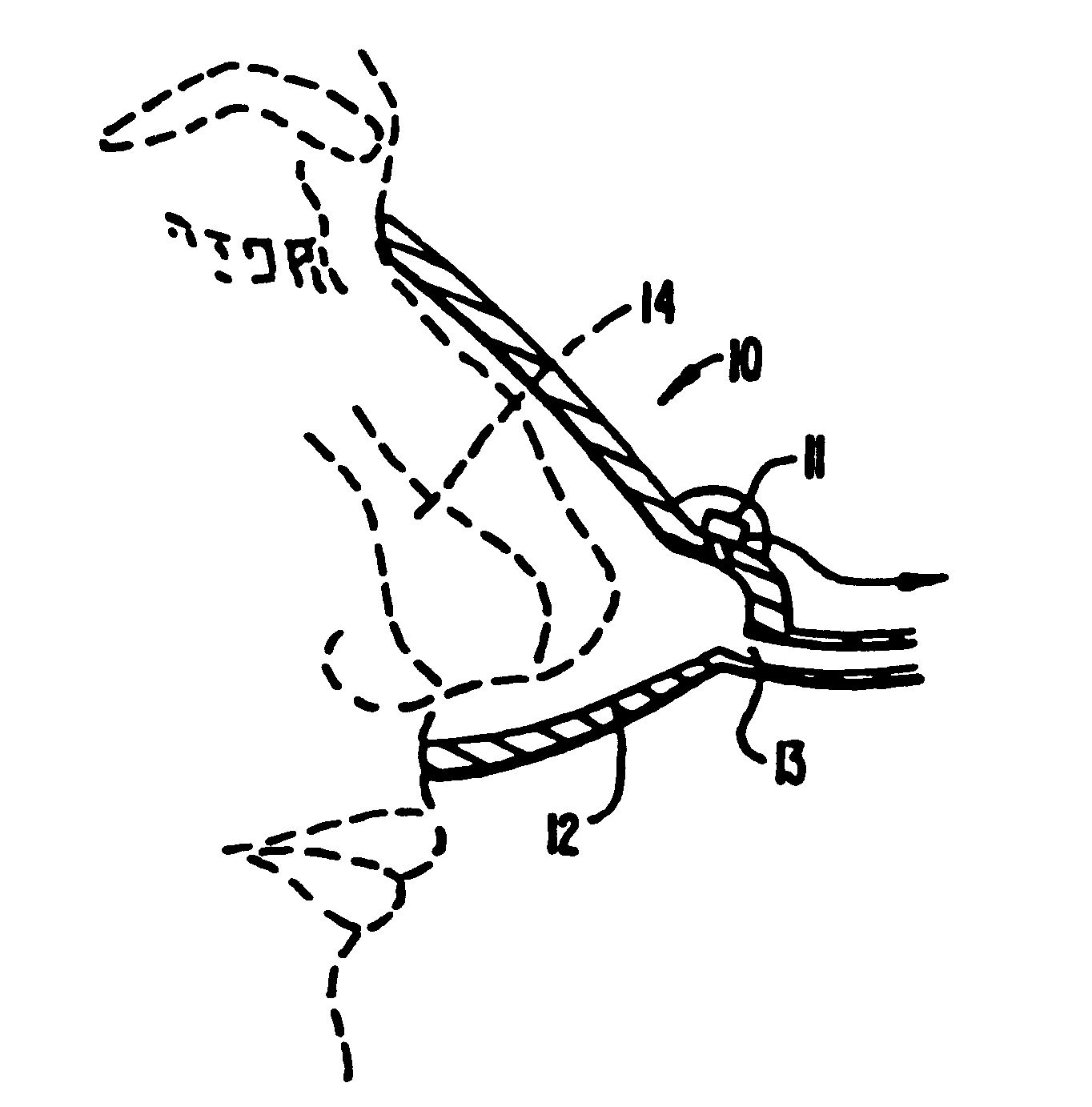 Device and method for nonclinical monitoring of breathing during sleep, control of CPAP treatment and preventing apnea