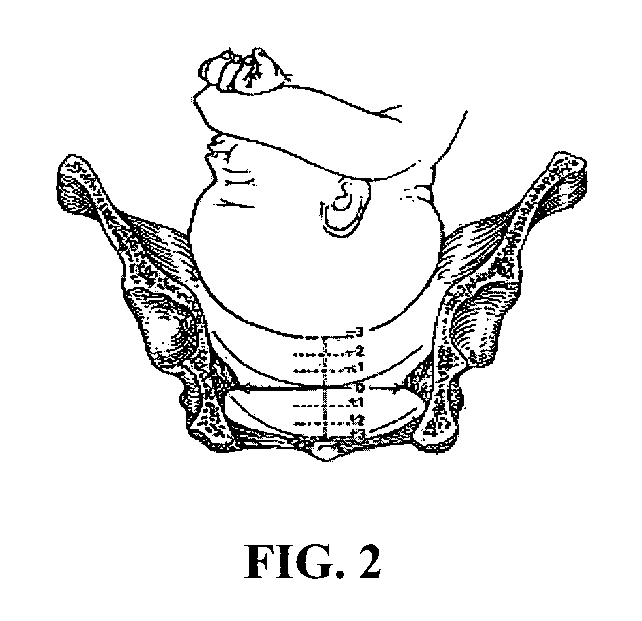 Method and apparatus for providing information related to labor progress for an obstetrics patient