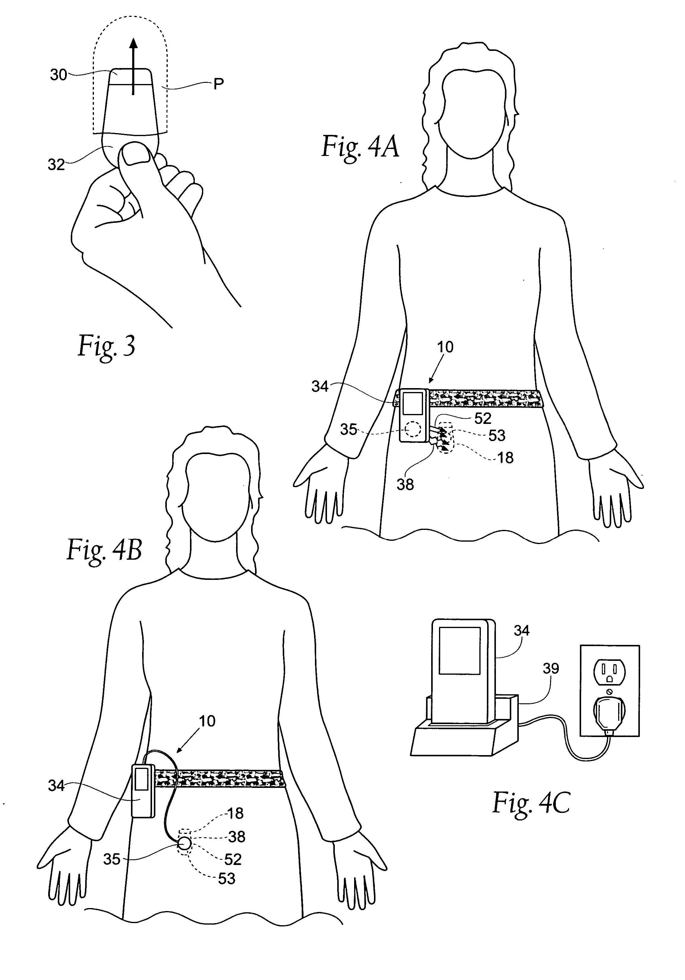 Implantable system and methods for acquisition and processing of electrical signals from muscles and/or nerves and/or central nervous system tissue