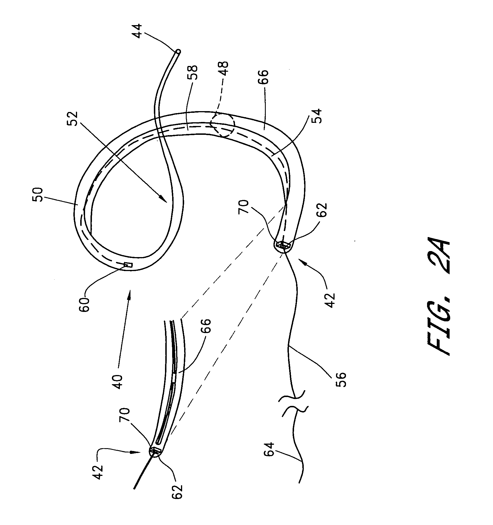 Heart valve leaflet locator