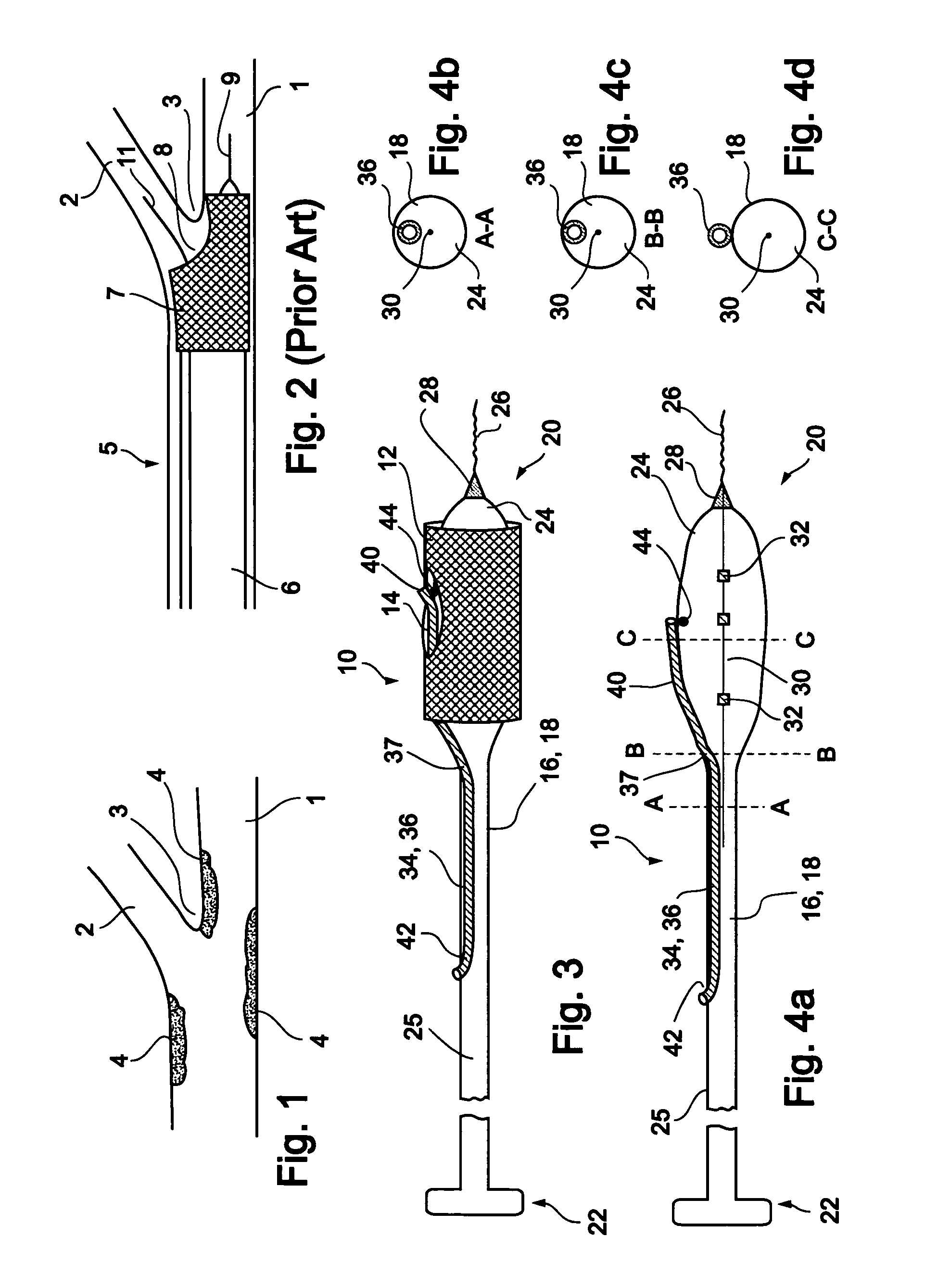 Stent delivery devices