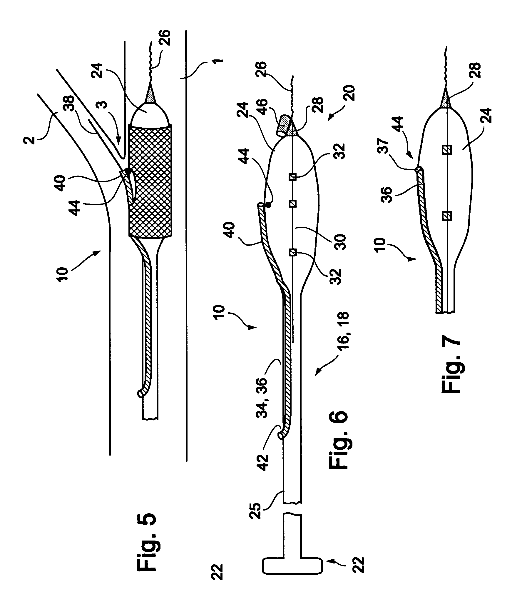 Stent delivery devices