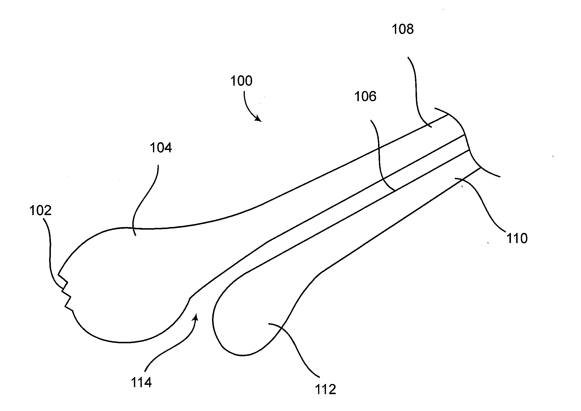 Cataract removal device and integrated tip