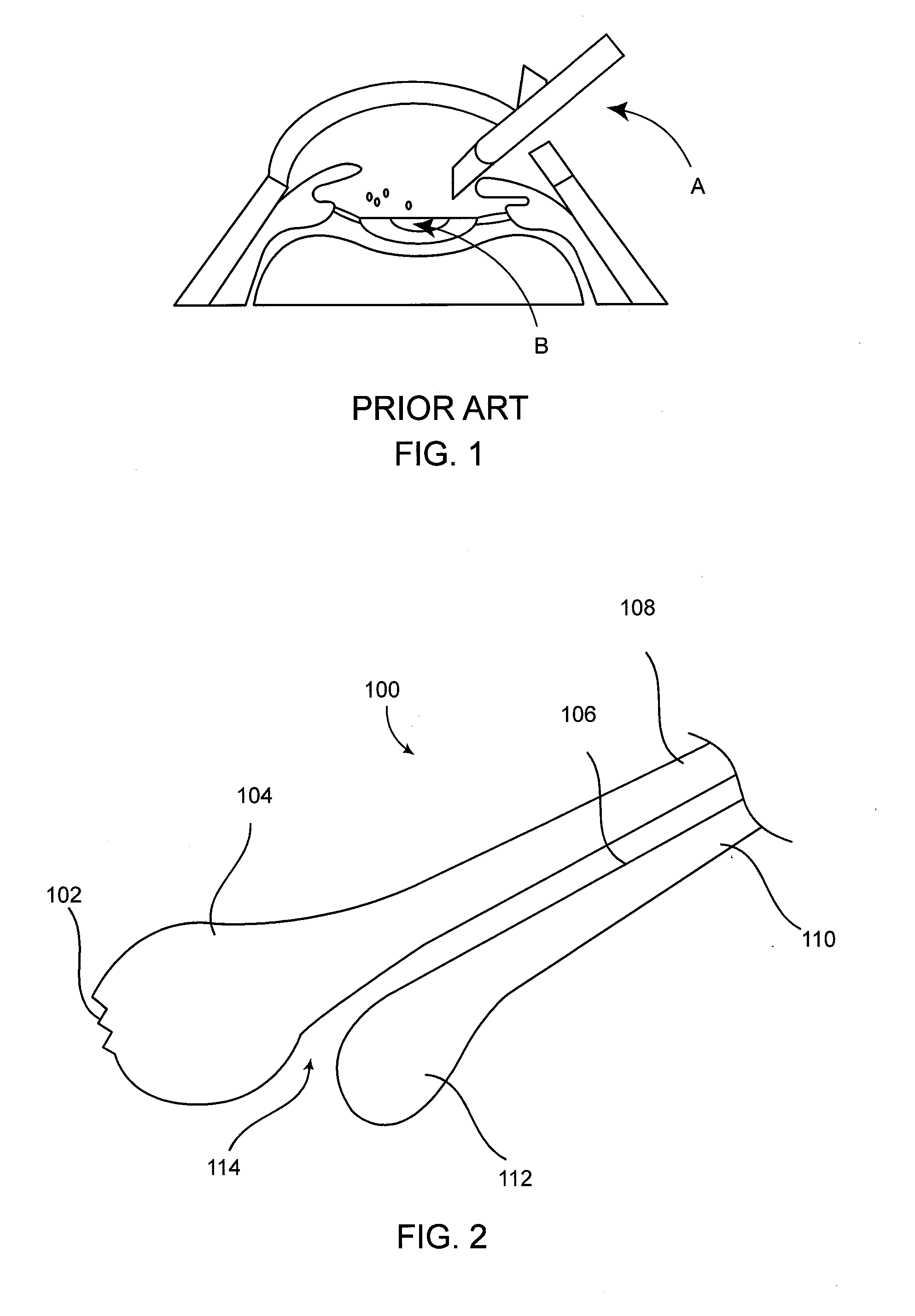 Cataract removal device and integrated tip